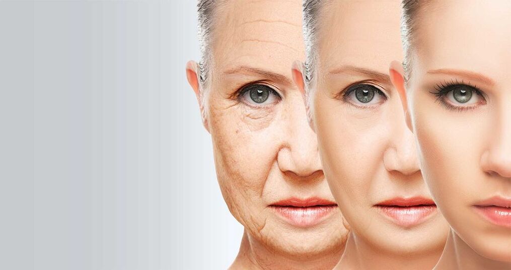 Facial skin rejuvenation using laser technology