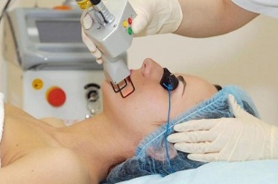 Types of laser facial rejuvenation